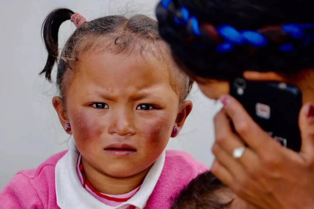 /ueditor/image/2019/08/02/3a1692d5311016c56e04203dc6c412b2.jpg 中国红基会西藏日喀则先心病患儿筛查活动正式启动4.jpg